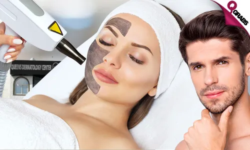 Carbon Peel & Laser Skin Lightening/Toning Treatments for Ladies & Men!